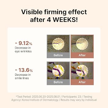 Siore NMN Intensive Serum | Plumping, Firming and Glow Face Serum with 99% Purity NMN 10,000ppm, Salmon DNA PDRN and Pycnogenol | Korean Pharmacy Anti-Aging Skin Care