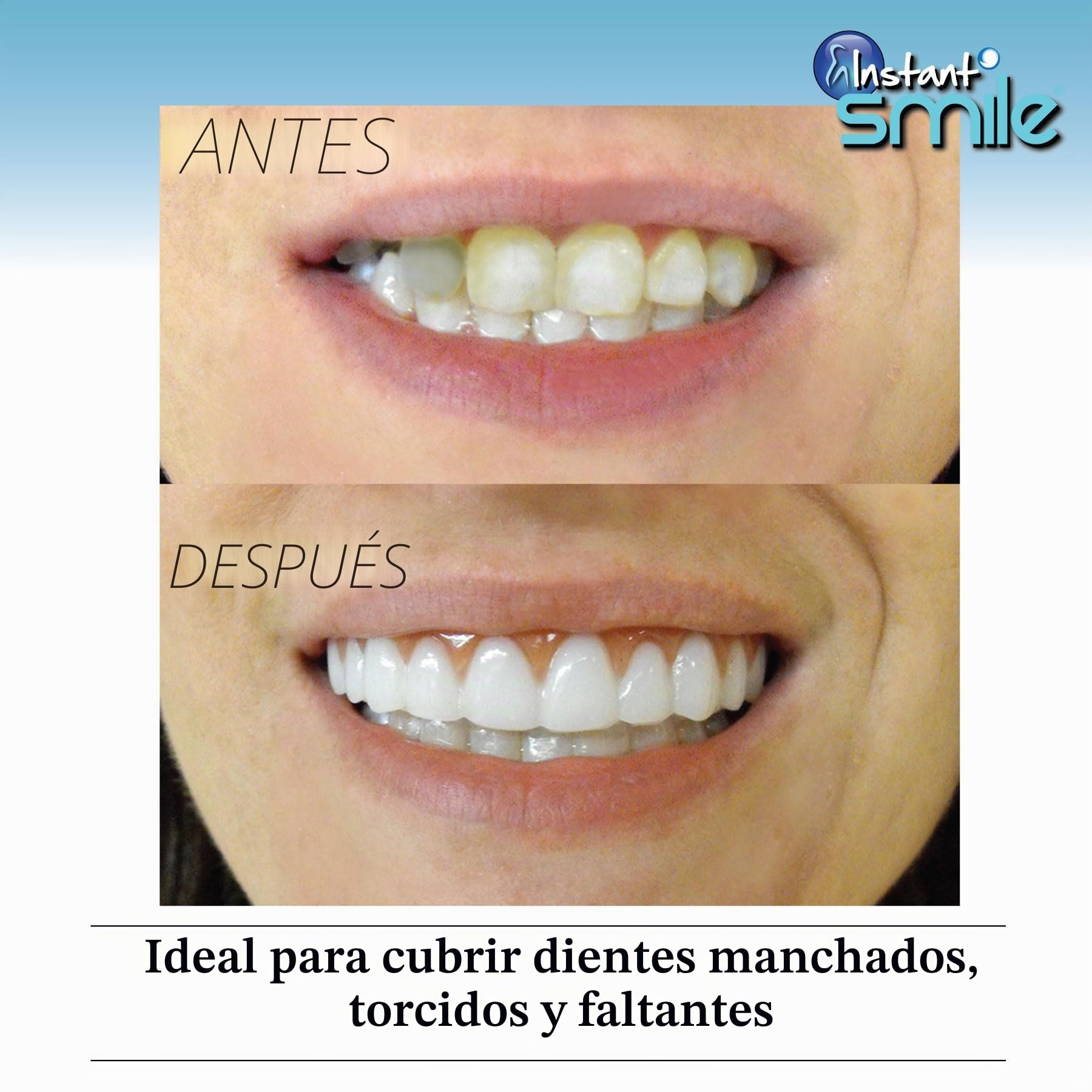 Instant Smile Comfort Fit Flex - Dientes superiores cosméticos, sombra natural, cómoda chapa superior para un uso prolongado, carillas de dientes para hombres y mujeres, 1 tamaño se adapta a la
