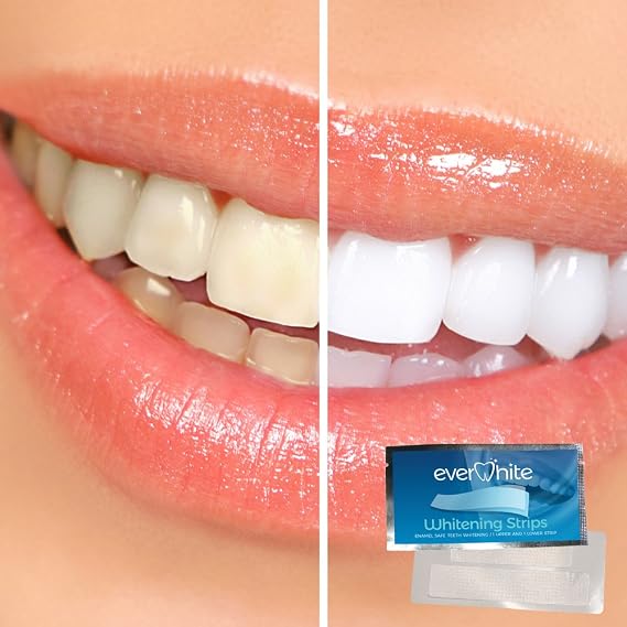 EverWhite Professional At Home Teeth Whitening Strips - 28 Pack