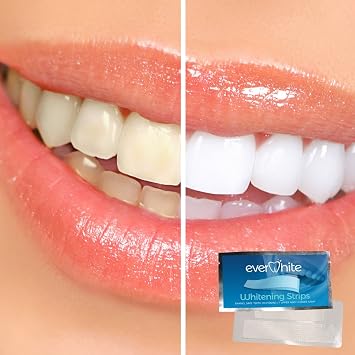 EverWhite Professional At Home Teeth Whitening Strips - 28 Pack