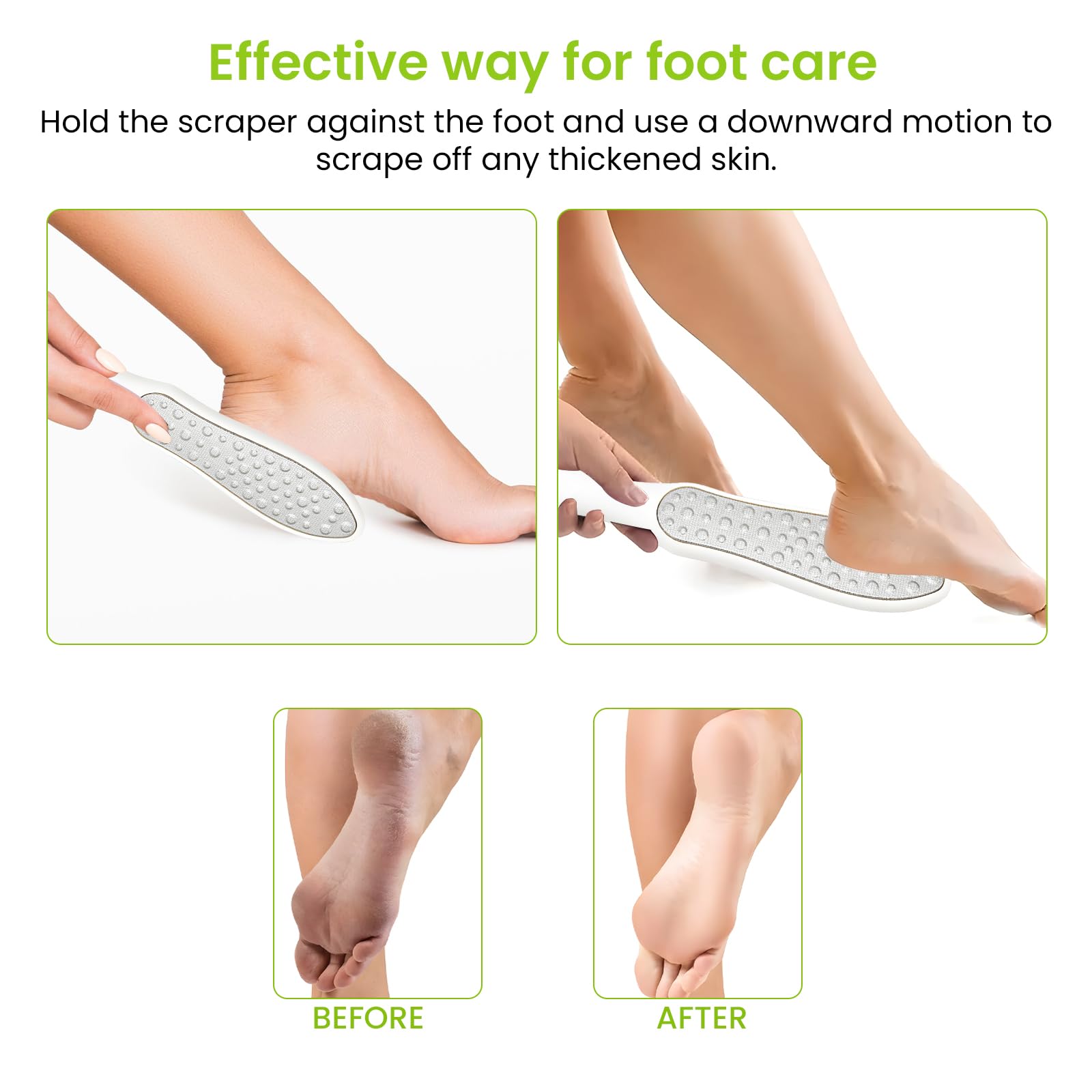 maxtachi 2 in 1 Feet Hard Skin Remover, Double Side Pedicure Foot File, Dead Hard Cracked Skin Calluses Remover, Highly Effective Foot File for Foot Spa-White - Image 4