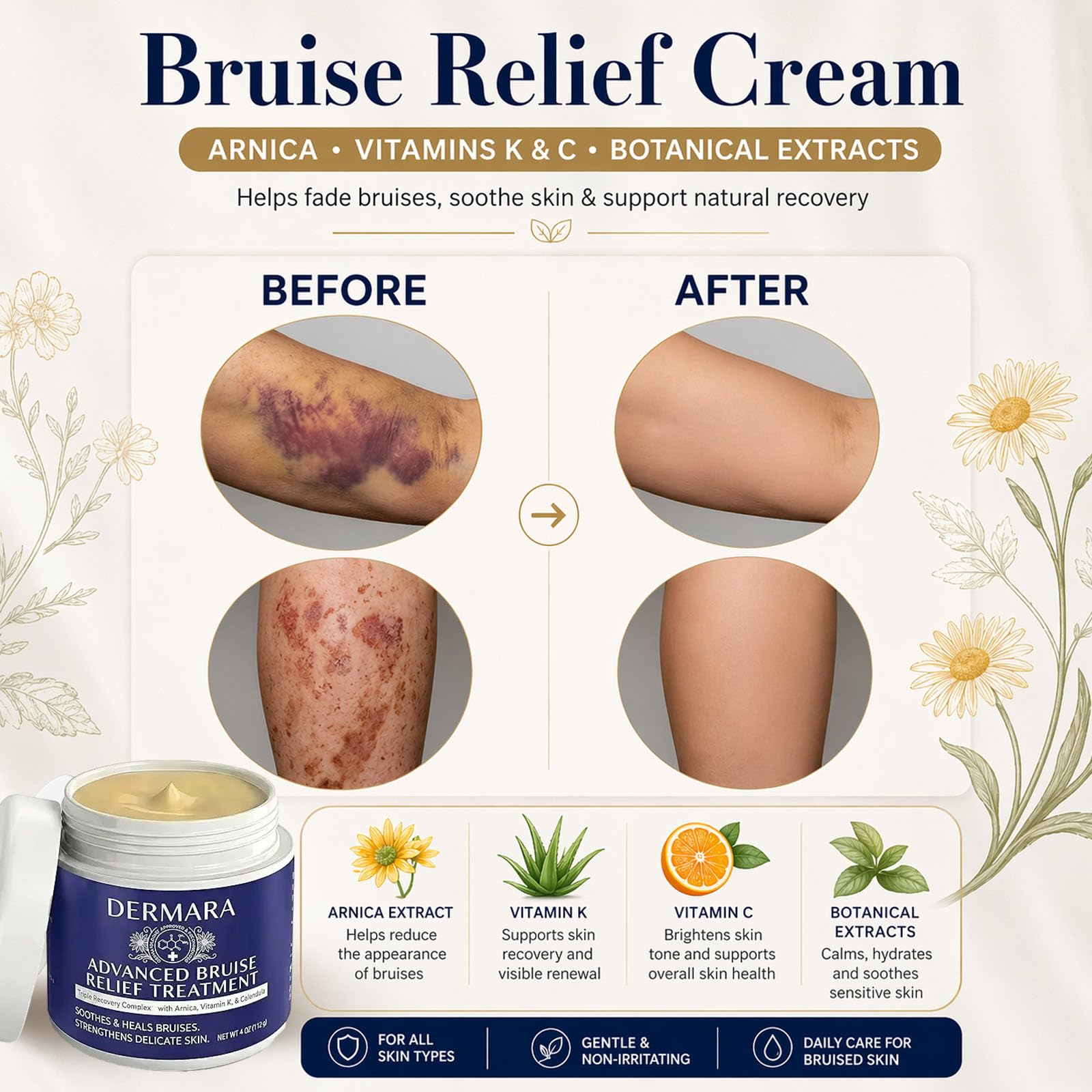 Dermara Arnica Cream for Bruises with Vitamins K, C and E, 4 Oz