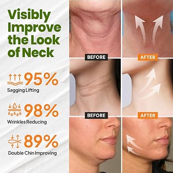 Advanced Firming & Wrinkle-Reducing Cream -Skin Firming Rejuvenating Cream, Skin Firming Rejuvenating Serum Deep Hydration, Skin Firming Rejuvenation for All Skin Types (1 Bottle)