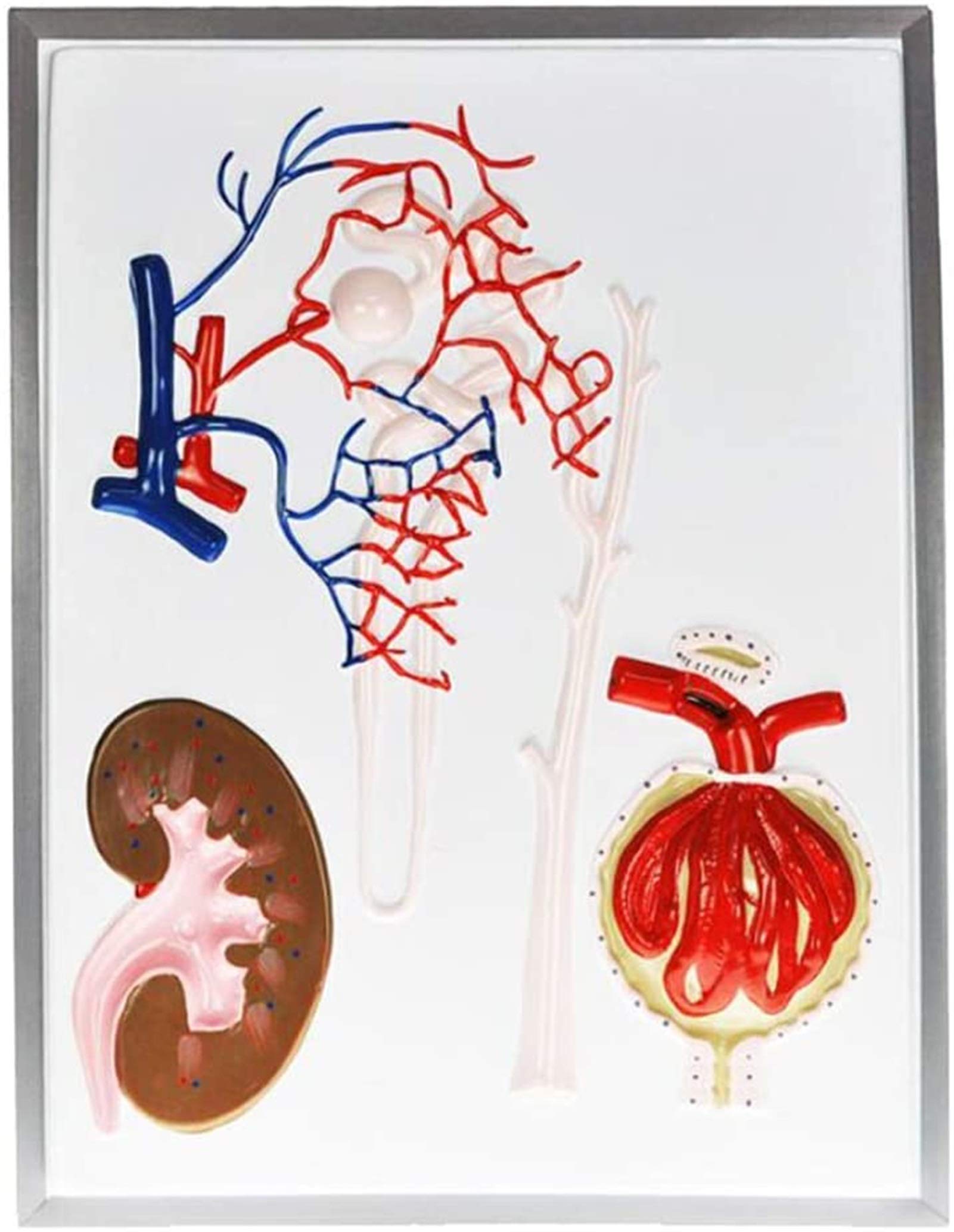 Renal Corpuscle:  The Fastest Way To Perfect Labeling! - 19312lt