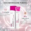 Arbutin 7% + Tranexamic Acid 4% Cream - Pigment Spot Remover Face Cream - Against Pigment Spots & Age Spots Removal - Glow Cre-me Face - Moisturising Cream Women (1 Piece)