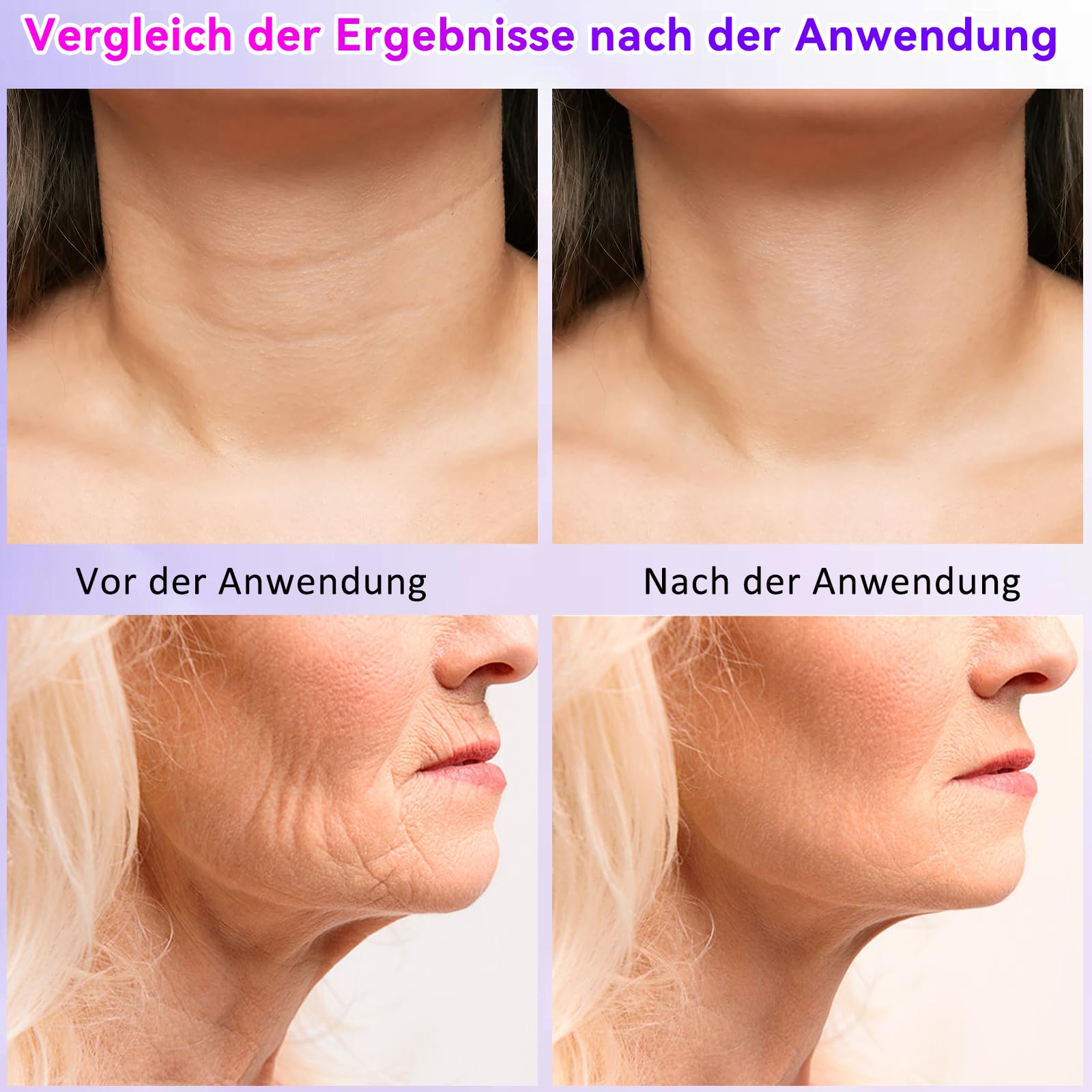 Elektrisches Gesichtsmassagegerät, Gesichtsmassagegerät gegen Falten, Rotlichttherapie-Gesichtsstraffungsgerät, Hautverjüngungs-Schönheitsgerät, Anti-Falten-Nacken für Hautstraffung & Lifting