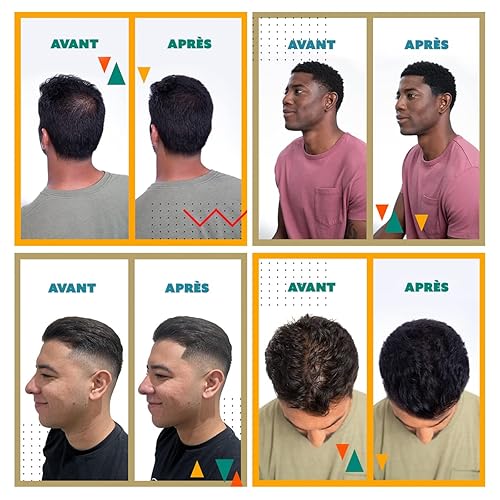 Miniatura 111 de Toppik Hair Building Fibers, Fill In Fine or Thinning Hair Instantly Thicker, Fuller Looking Hair 9 Shades,4 size options