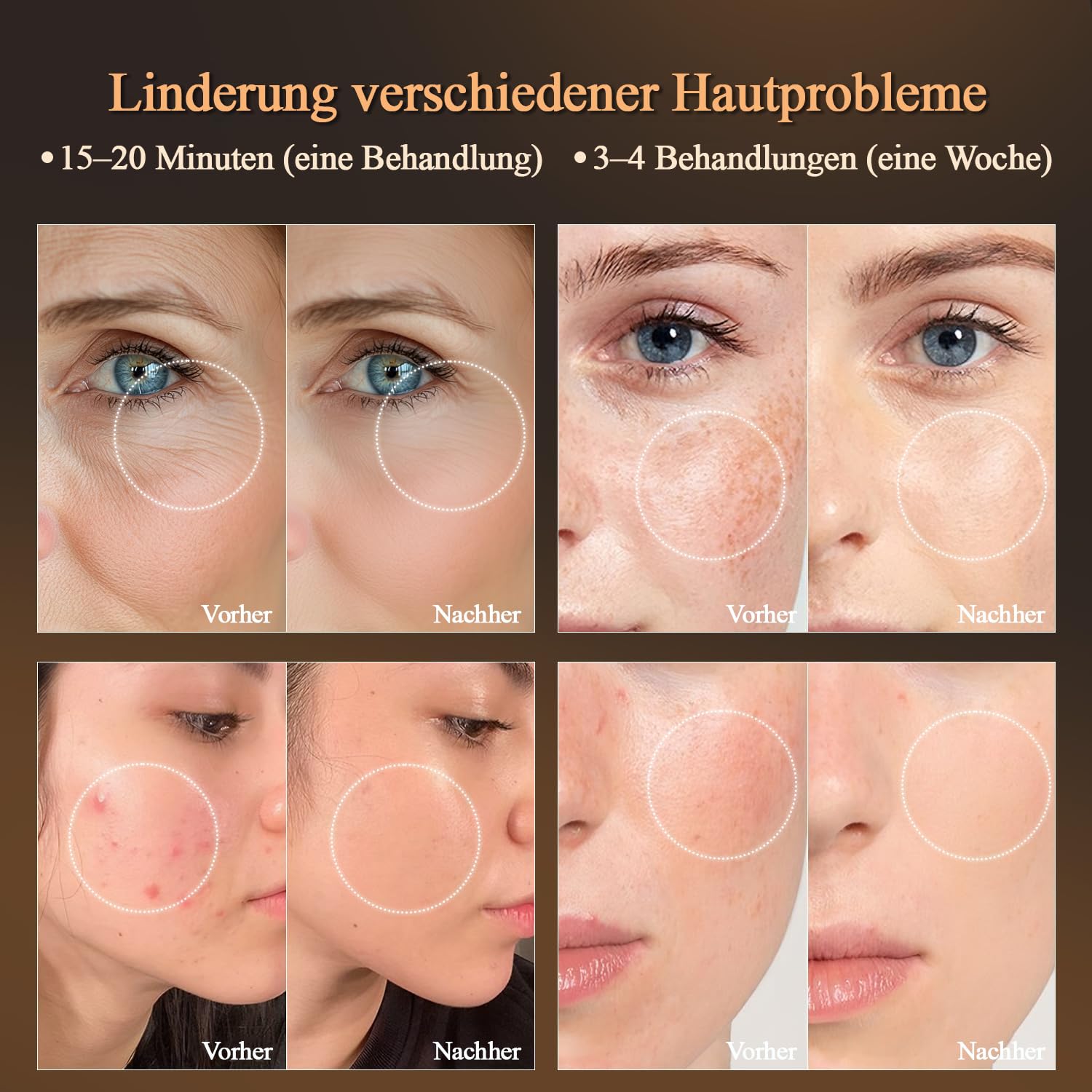 MEGELIN LED Lichttherapie Gesichtsmaske, Lichttherapie Maske, 7 gezielte Lichtmodi, Infrarot-Licht Hautverjüngung, Akne Reduktion Hautpflege, Anti-Aging, reduzieren Falten glatte Haut, Rotlichtmaske