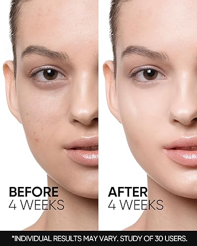 Miniatura 6 de Crema hidratante renovadora de la piel con retinol, crema de retinol para el rostro, cuidado de imperfecciones, control de grasa y minimización de