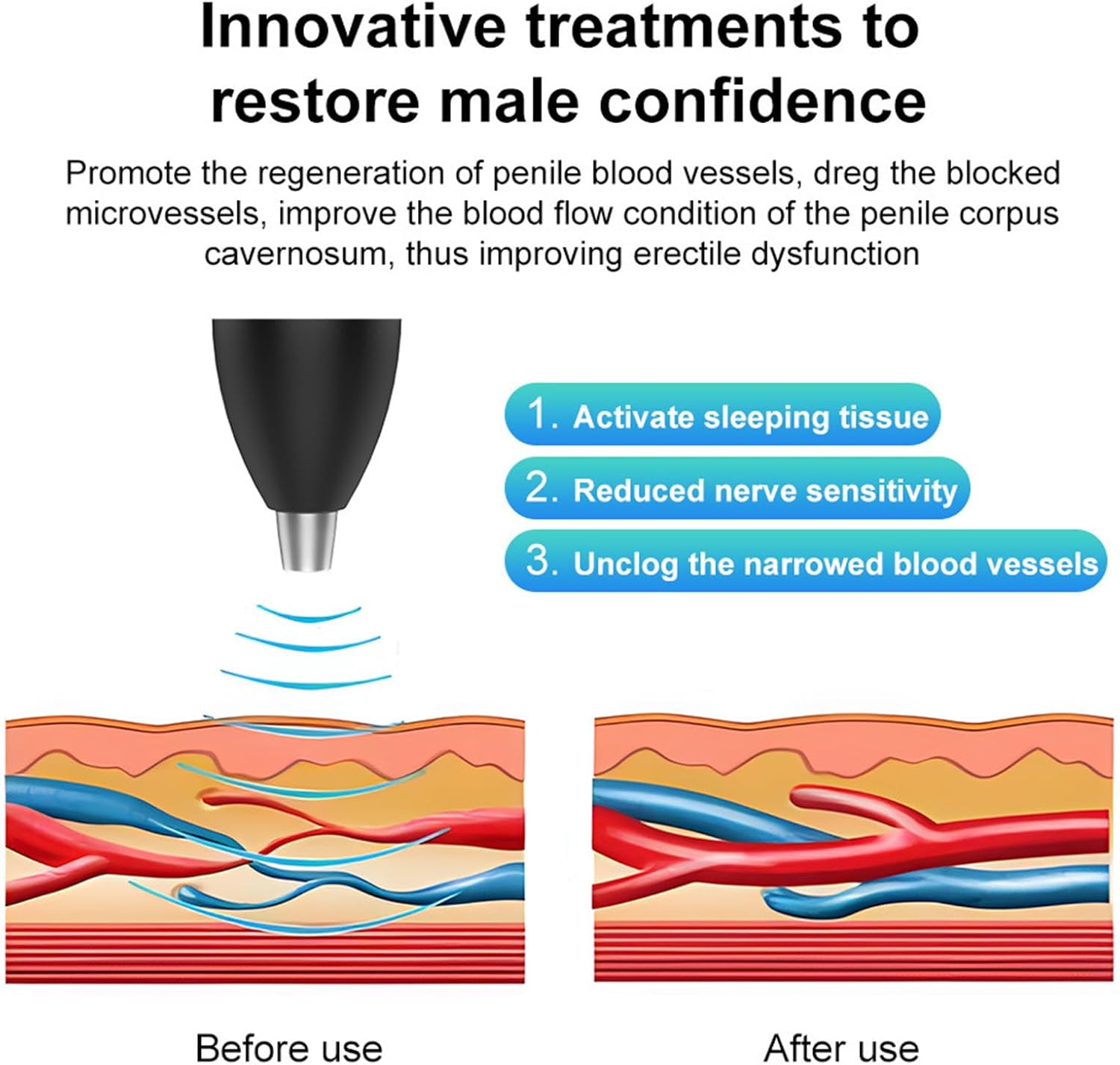 Portable Shockwave Therapy Machine, Handheld Quiet Extracorporeal E-D Shock Wave Therapy Devices, OLED Display, 3-Level Adjustment, for Body Muscle Relaxation