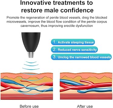 Portable Shockwave Therapy Machine, Handheld Quiet Extracorporeal E-D Shock Wave Therapy Devices, OLED Display, 3-Level Adjustment, for Body Muscle Relaxation