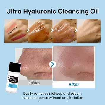 coxir Ultra Hyaluronic Holiday Gift Set Cleansing Oil + Toner + Ampoule + Cream |Mini Skincare Kit, Travel-Size Korean Skincare Set, Hydrating Routine