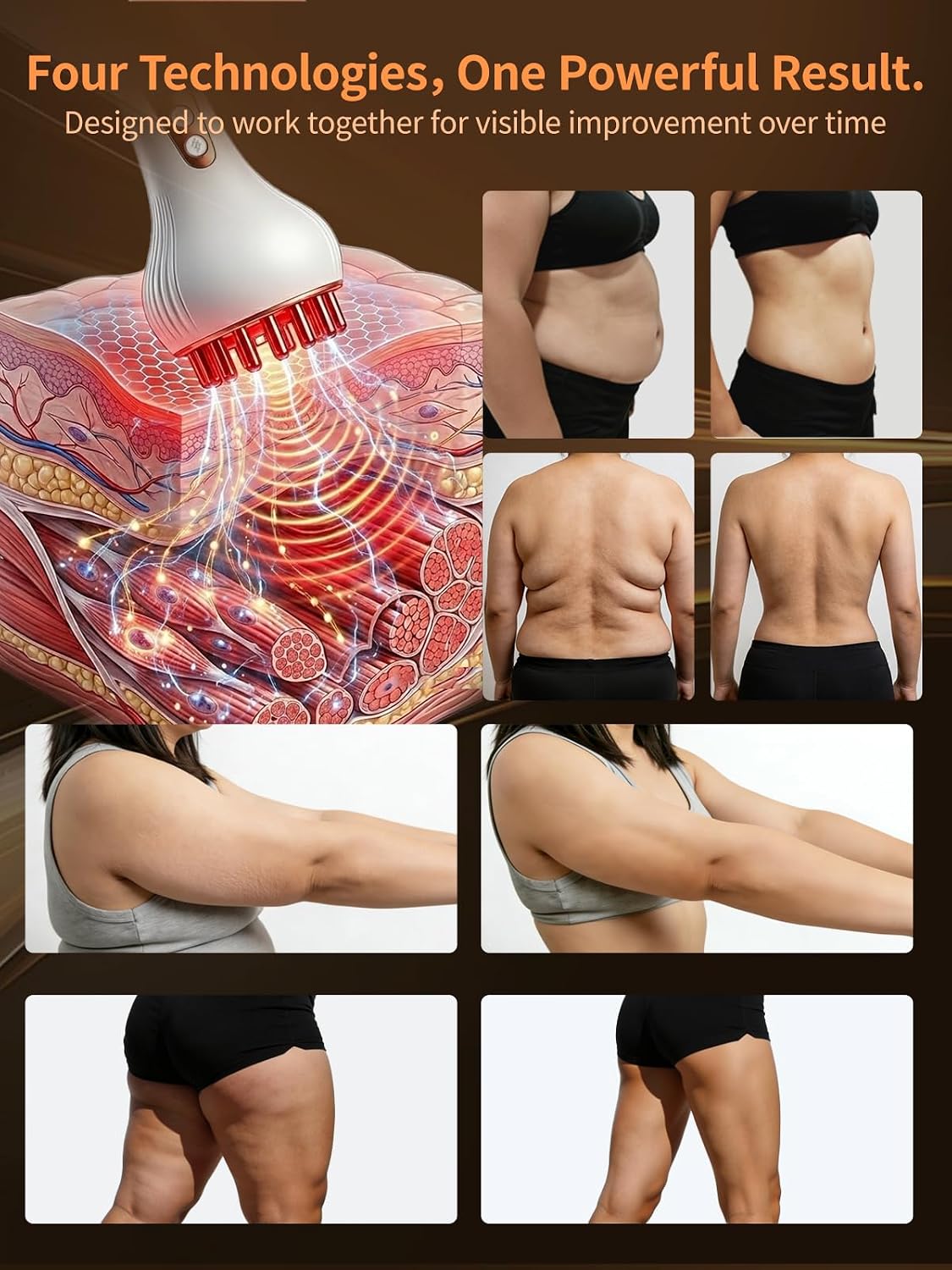 Lymphatic Drainage Massager for Full Body, Body Sculpting Machine & Cellulite Massage Tool for Skin Smoothing, – Relieves Muscle Tension, Reduces Cellulite, and Enhances Skin Firmness-White