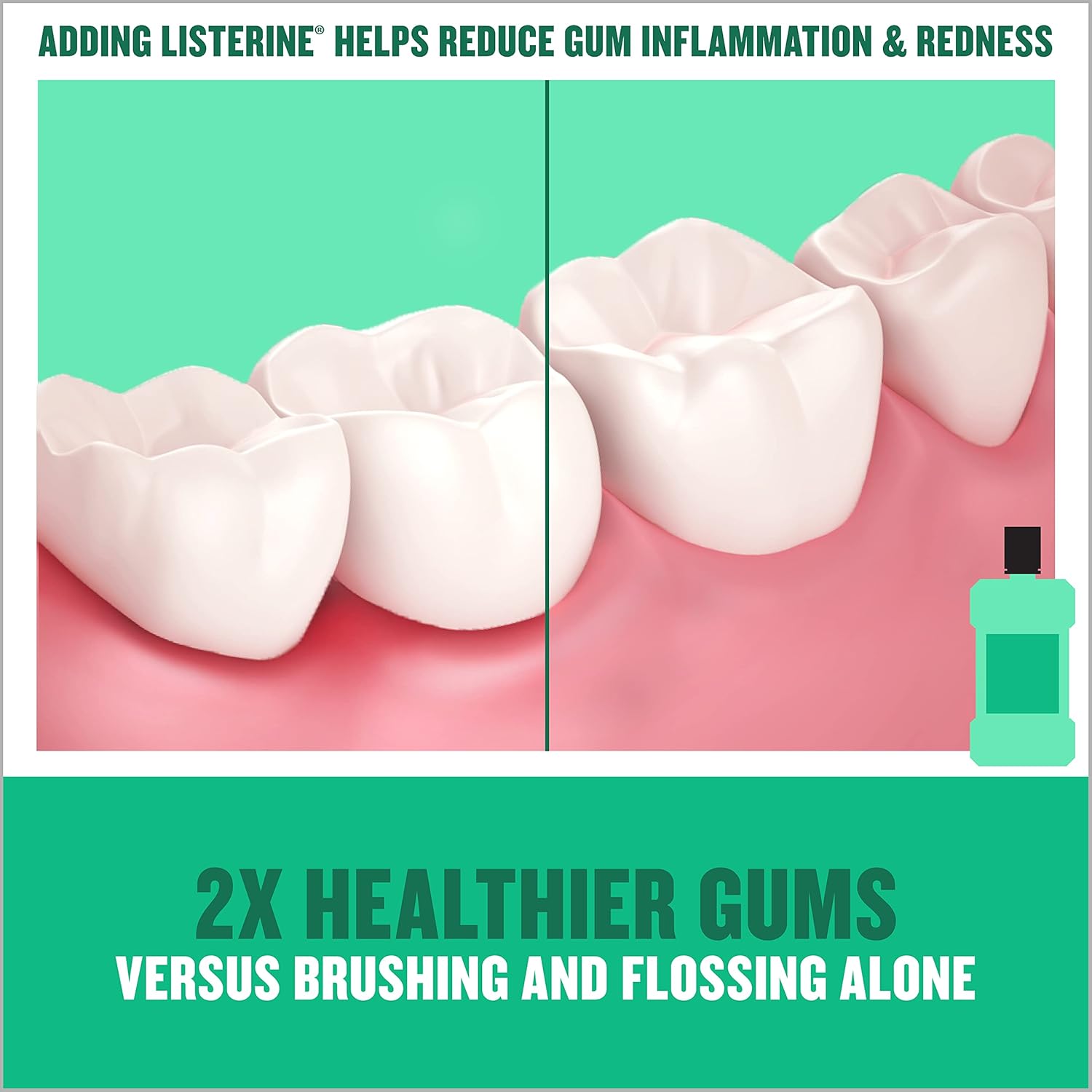 Listerine Freshburst Antiseptic Mouthwash for Bad Breath, Kills 99% of Germs That Cause Bad Breath & Fight Plaque & Gingivitis, ADA Accepted Mouthwash, Spearmint, 1 L, Pack of 2 : Health & Household