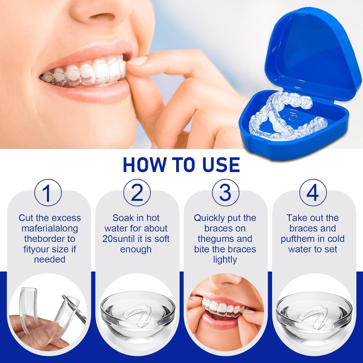 Set of 4 Anti-Snoring Splints, Anti Snoring Devices for Bruxism, Anti-Snoring Mouth Guard, for Better Sleep, Improves Sleep and Reusable