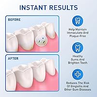 Vista 4 de Puntas de repuesto para Waterpik, cabezales de repuesto para Waterpik (6 puntas clásicas de chorro)