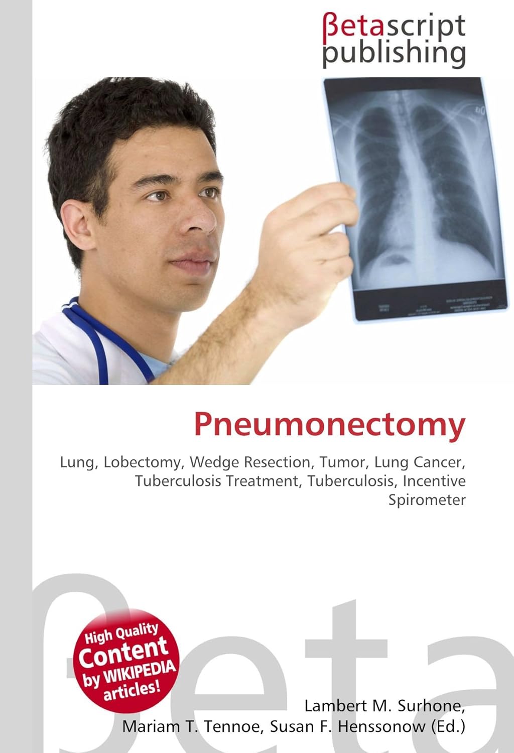 Pneumonectomy Lung, Lobectomy, Wedge Resection, Tumor, Lung Cancer