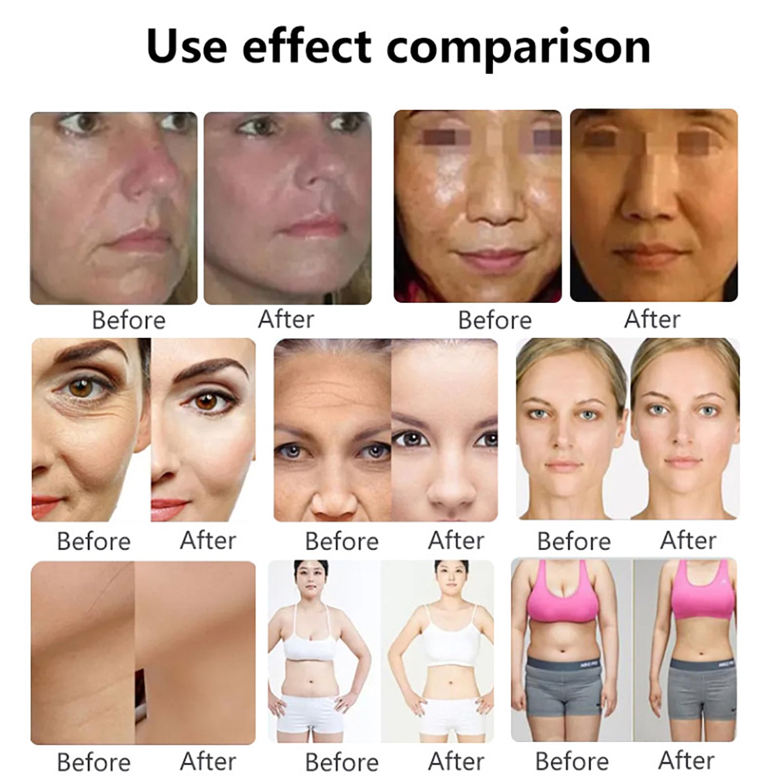 Machine Lifting Magnétique,machine Beauté Pour Soins Peau 7D Avec 1 Poignée Et 3 Sondes Profondeur, Énergie Réglable 1-10J Et Fréquence 1-8Hz,absorption Complète À 100%, Effet Visible 15 Minutes