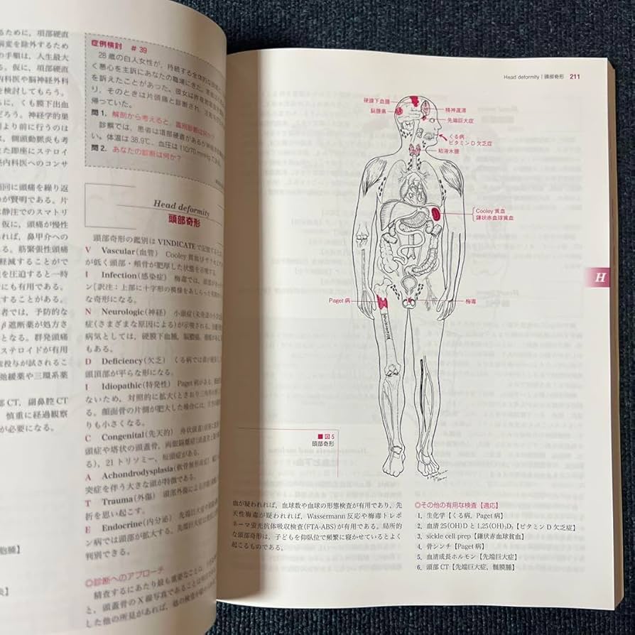 Amazon.co.jp: コリンズのVINDICATE鑑別診断法 13 : おもちゃ