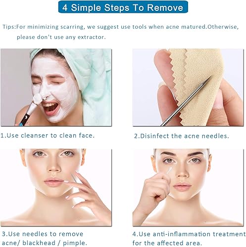 Miniatura 9 de 5 piezas extractor de comedona removedor de puntos negros kit de pinzas curvadas de puntos negros kit profesional de herramientas de eliminación de