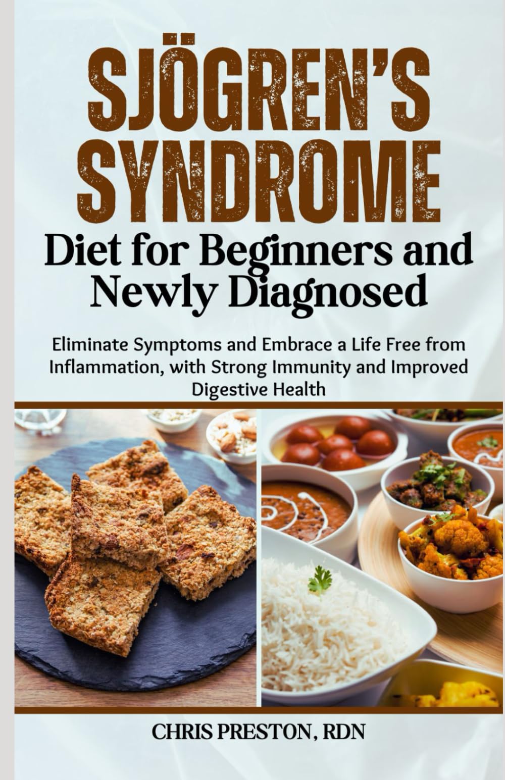 Sjögren’s Syndrome Diet for Beginners and Newly Diagnosed: Eliminate Symptoms and Embrace a Life Free from Inflammation, with Strong Immunity and Improved Digestive Health