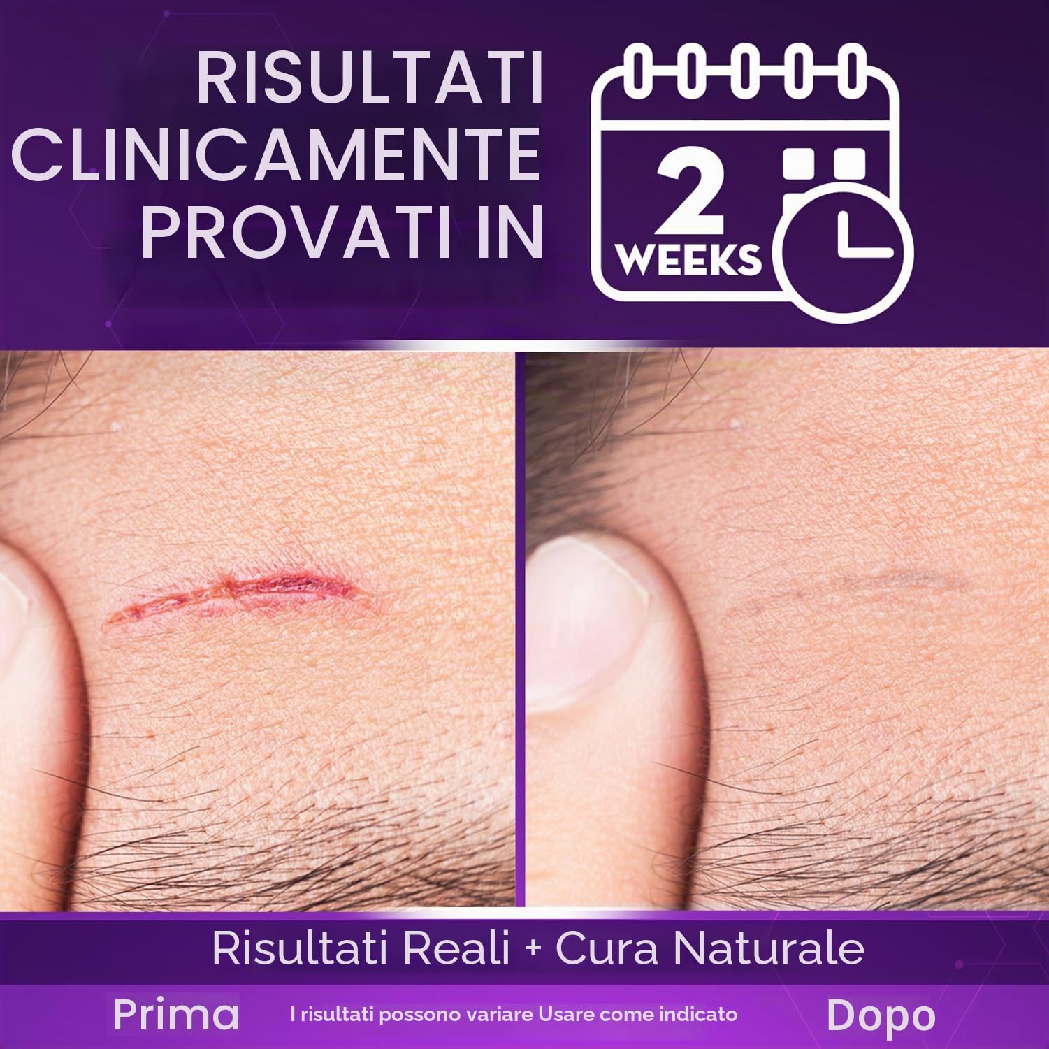 Cicatricure Gel per cicatrici viso e corpo, riduce la comparsa di cicatrici vecchie e nuove, smagliature, chirurgia, lesioni, ustioni e acne, 28,3 g (la confezione può variare)