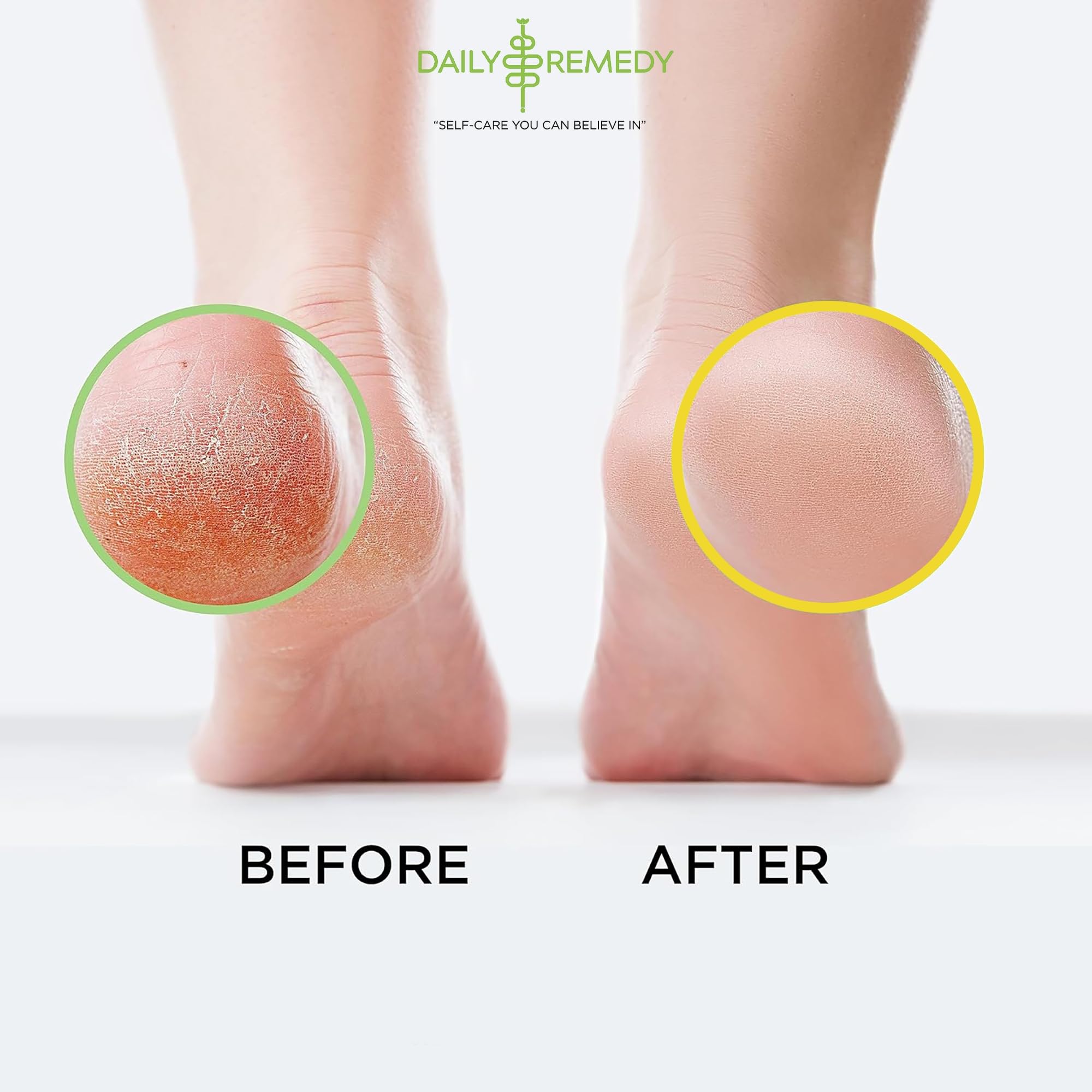 DAILY REMEDY Tea Tree Oil & Citrus Foot Soak Set with Natural Salts