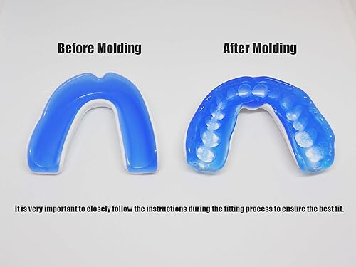 Miniatura 5 de COOLLO SPORTS Protector bucal para hervir y morder (jóvenes y adultos) DA Boquilla deportiva de ajuste personalizado para fútbol, hockey, rugby,