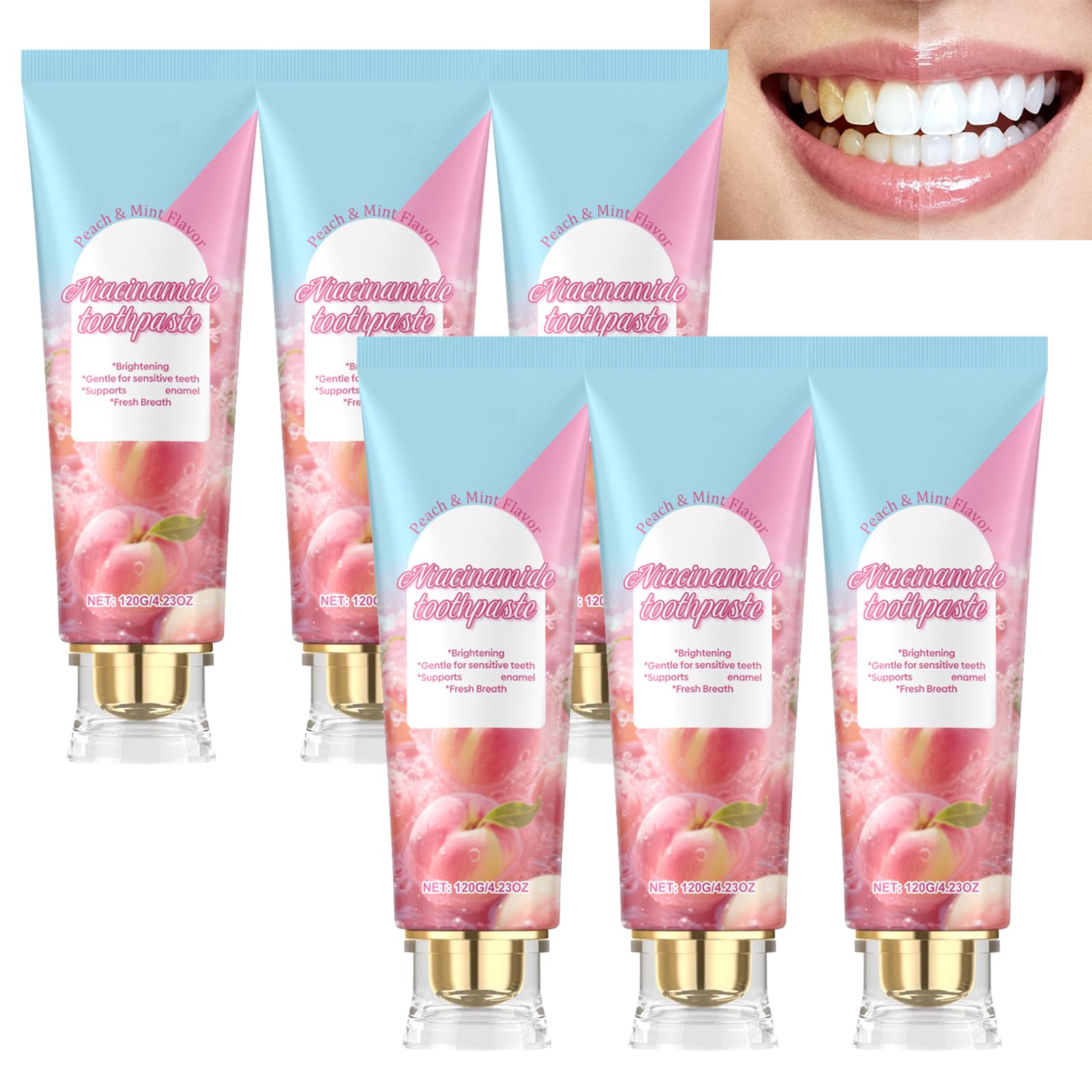 Dentifrice Blanchissant À La Niacinamide Pour Éliminer Les Taches Et Protéger L'émail, Dentifrice Doux Pour Dents Sensibles, Soin Complet Des Dents Contre Les Taches De Café Et De Thé (6pcs)