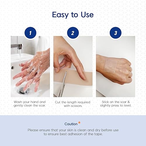 Miniatura 7 de MURASAKI BEAUTY Cinta y hojas de silicona para cicatrices  Eliminación de queloides, quemaduras, abrasión, cesárea y cicatrices quirúrgicas  Seguro