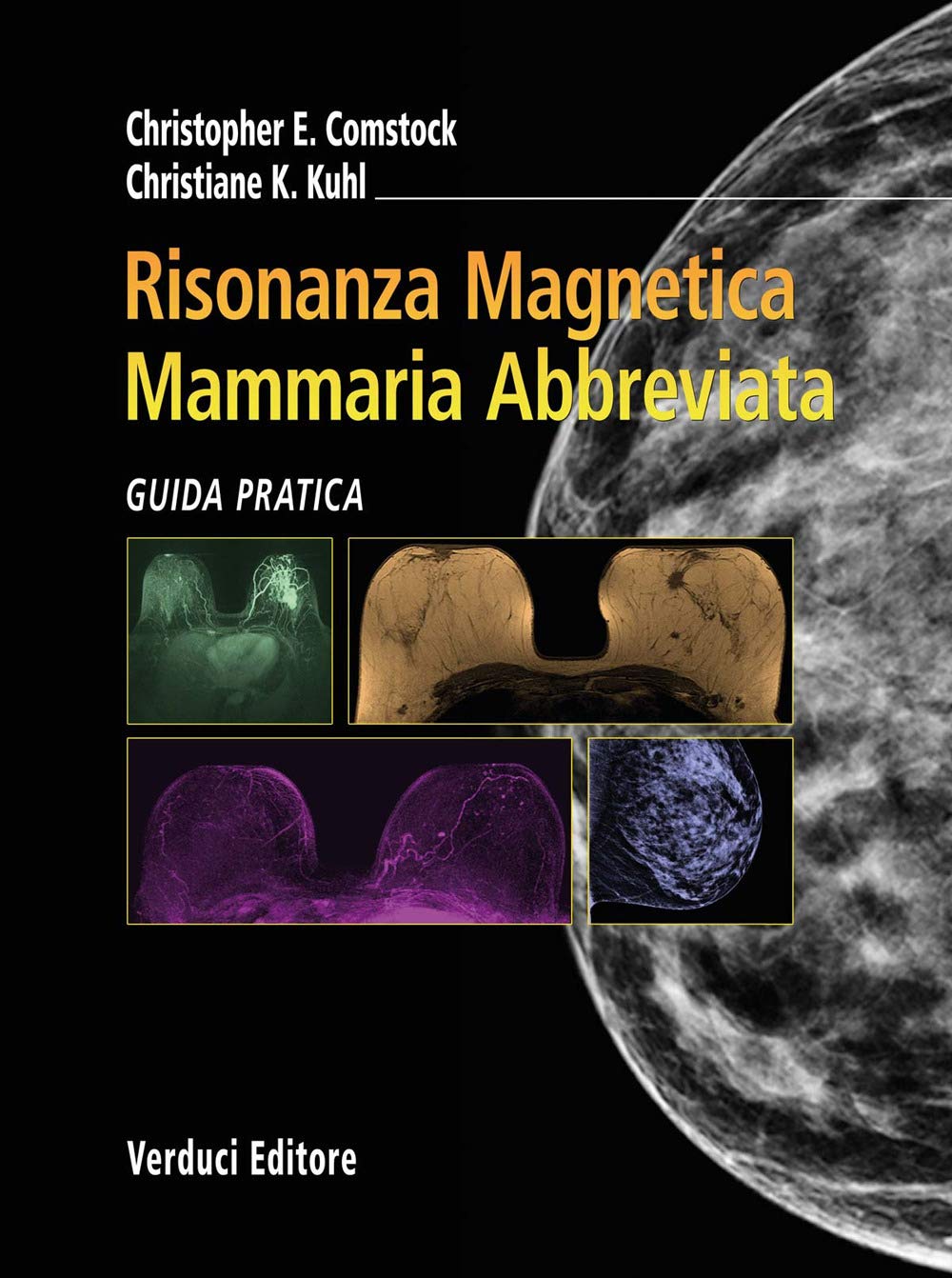 Risonanza Magnetica Mammaria Abbreviata. Guida Pratica - 4