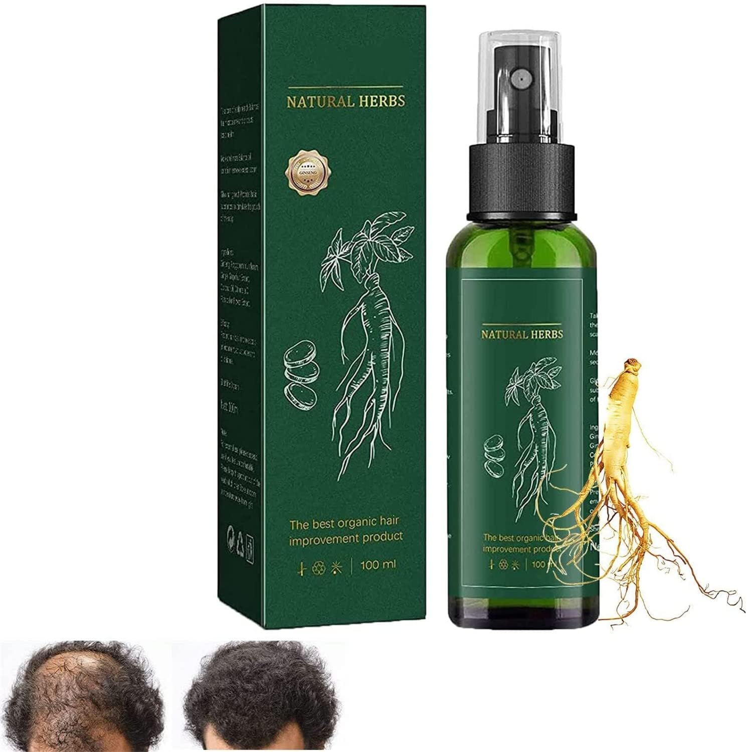 KORTIN Red Ginseng Hair Regeneration Spray - Hyungang Korea Ginseng Hair Regrowth Serum Spray,Ginger Hair Growth Spray Serum,Nourish Scalp Hair Anti-Hair Loss for Women & Men (1 Pcs)