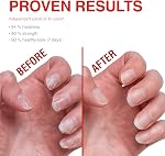 Probelle Renforceur de ongles, traitement de renforcement des ongles, croissance des ongles et réparation, stoppe l'épluchage, les fentes, les copeaux, les fissures et renforce les ongles (0.50 Des onces, 1)