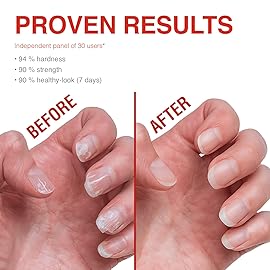Probelle Nail Strengthener and growth, Natural Nail Strengthening Clear Nail Polish Repair Treatment, Nail Growth & Conditioning, Stops Splits, Chips, Cracks & Strengthens Damaged and Thin Nails