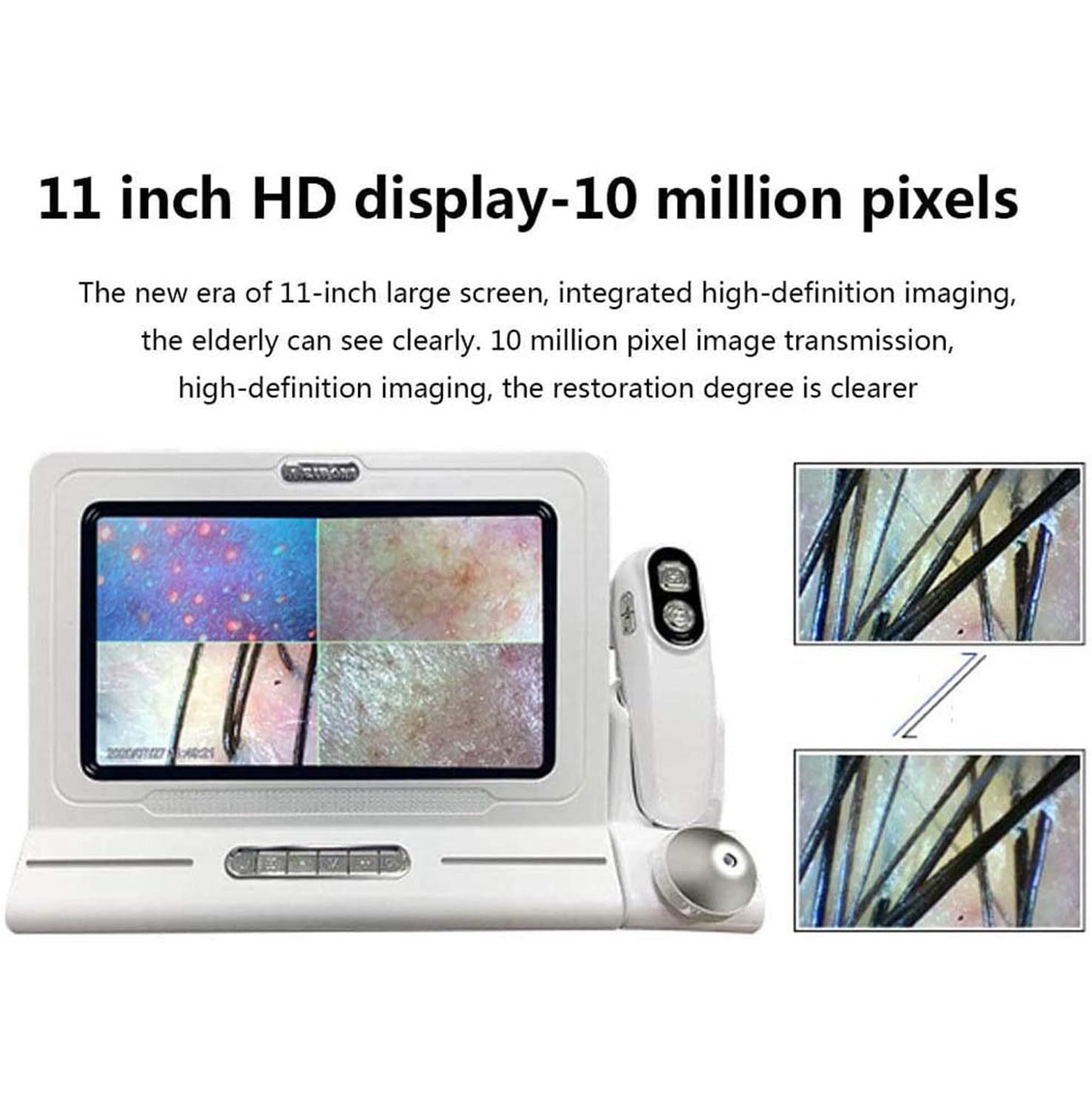 Haar-Haut-Analysegerät, Hautdiagnose-Haaranalysegerät, Con cabezales duales de 50x/200x y un tamaño de folículo de 11 pulgadas, Ideal para salones de belleza