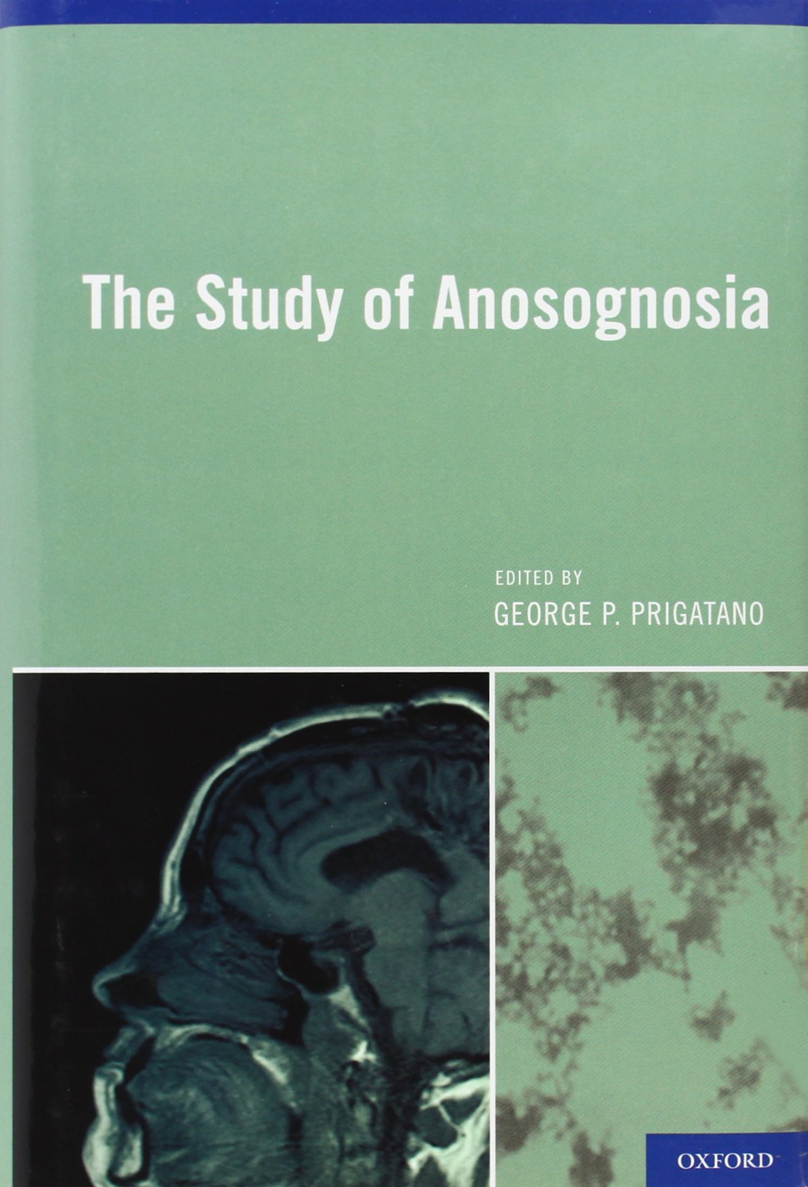 The Study of Anosognosia