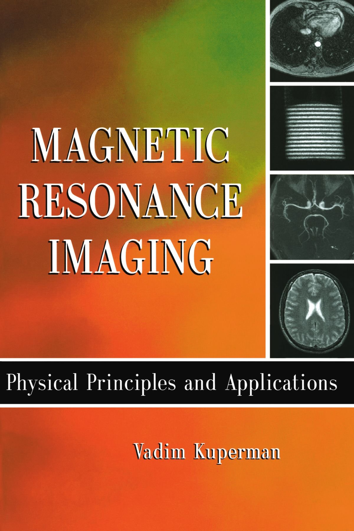 Magnetic Resonance Imaging: Physical Principles and Applications