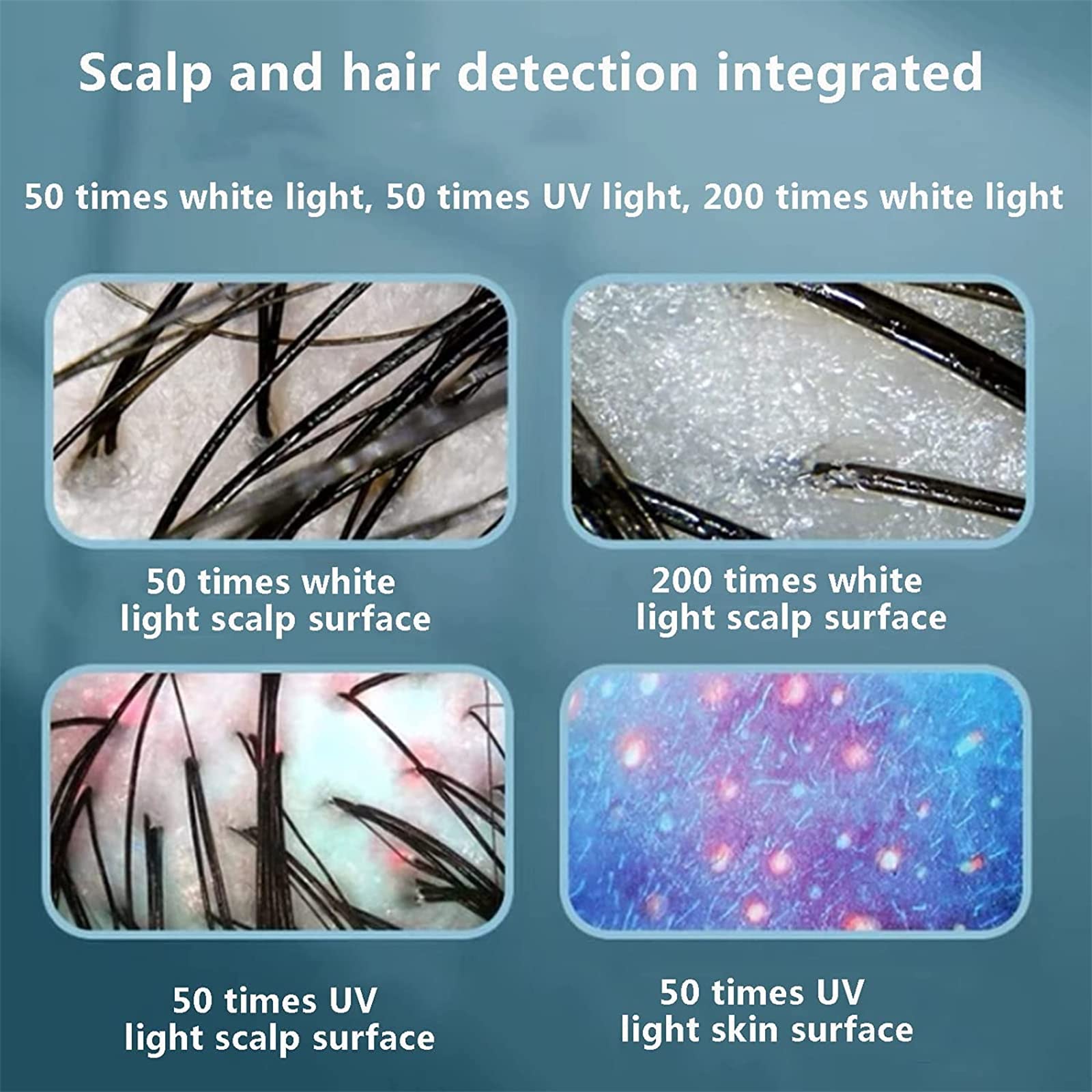 50X/200X Analizador de Cabello para diagnóstico de Piel, Pantalla LCD de 15 Pulgadas Máquina analizadora de Piel para diagnóstico de Piel Digital Operación Simple