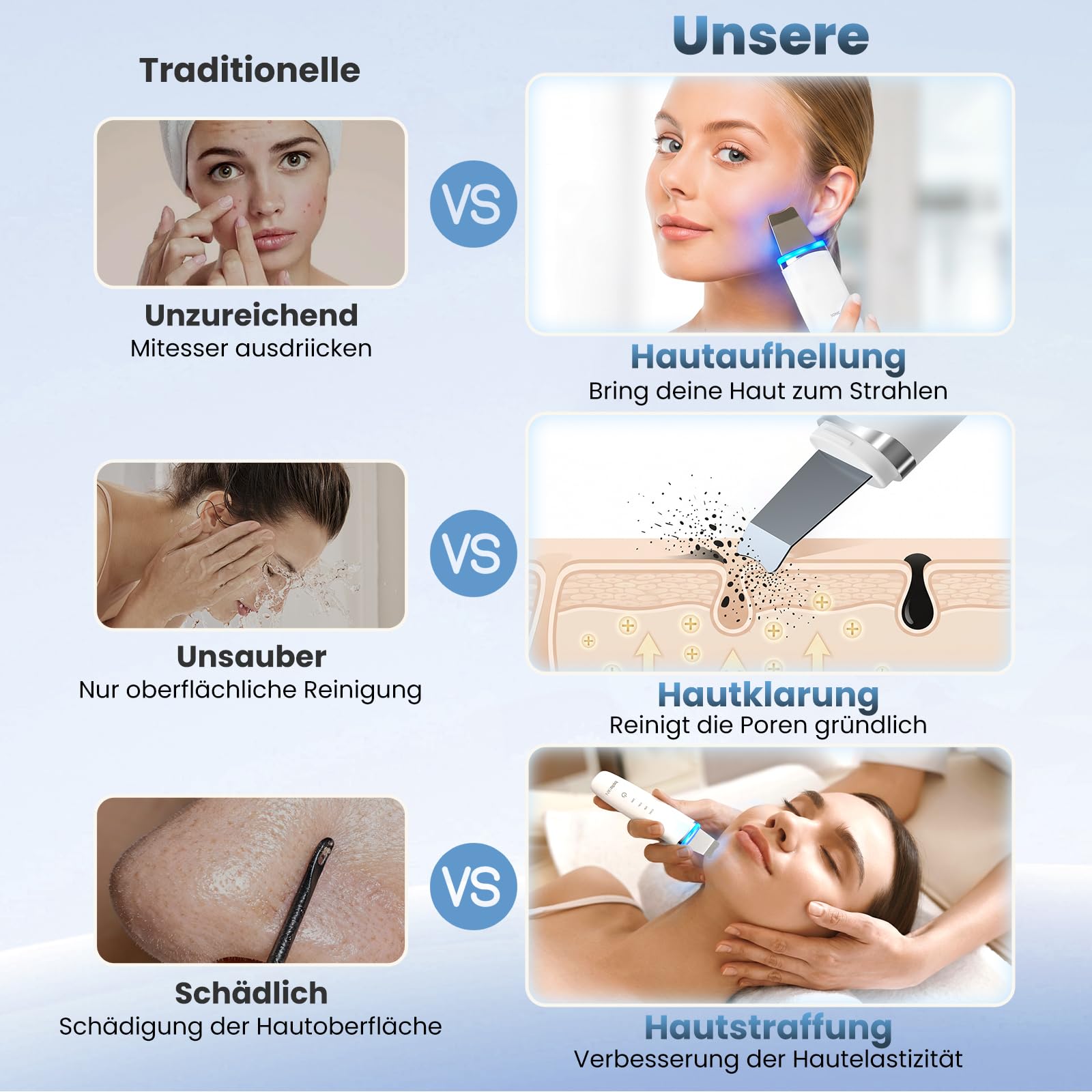 4-in-1 Skin Scrubber Ultraschall, IPX7 wasserdicht Porenreiniger
