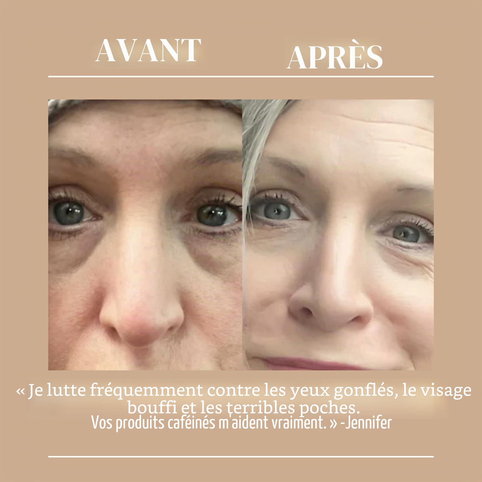 Crème pour les yeux à l’extrait de café UPCIRCLE pour les cernes, les poches et les rides, naturelle, végétalienne + sans cruauté ...