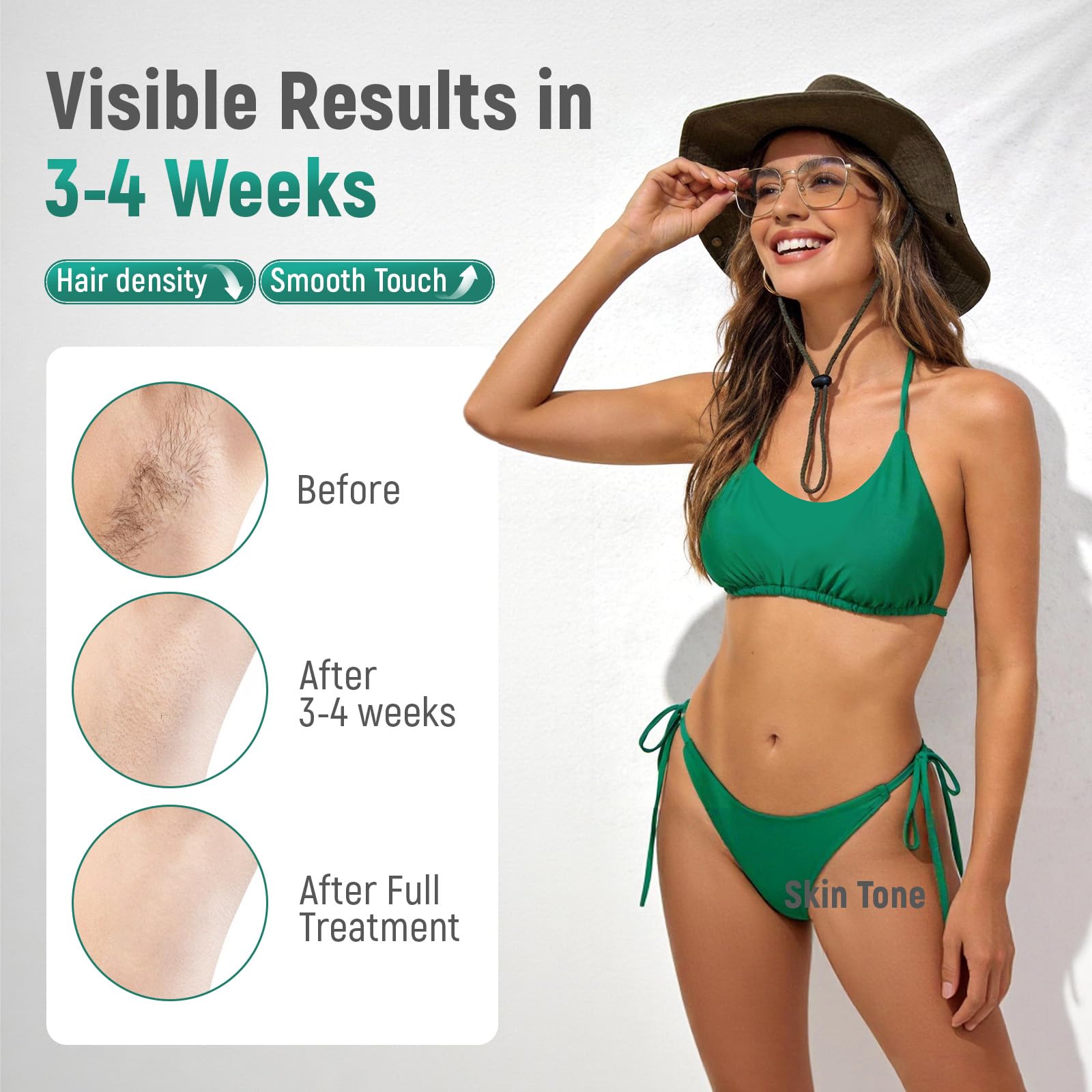 IPL Laser Hair Removal Device with Ice Cooling