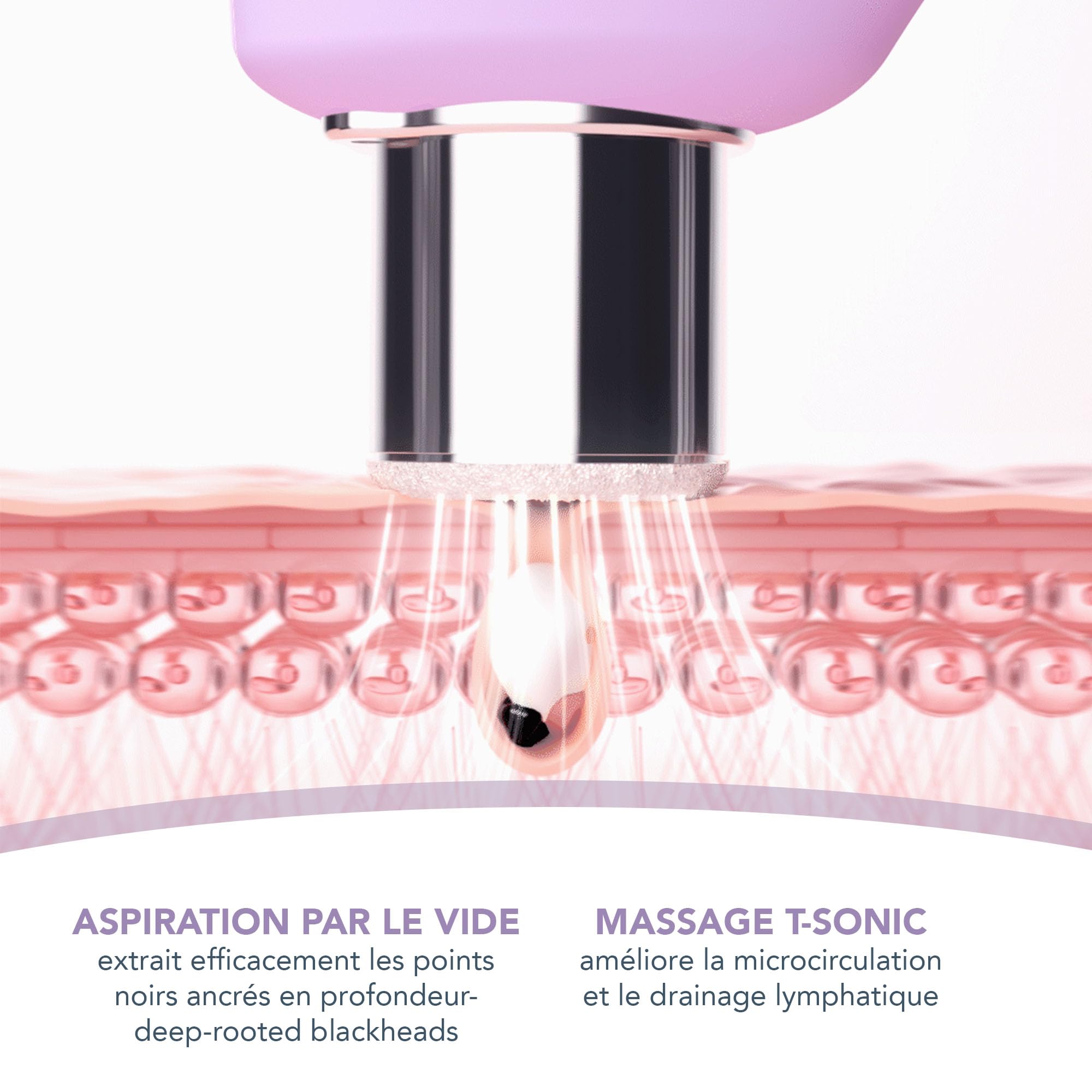 FOREO Smooth & Resurface KIWI derma Microdermabrasion - Extracteur point noir visage + KIWI Masque actif pores et points noirs 100g - Aspirateur point noir - Sans bandelettes - Aspirateur point noir