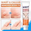 Skin Tag Remover and Verruca Treatment, 20g Wart Removal Cream for Effective and Safe Results. Gently Removes Corns on Feet and Hands, Keeps Skin Smooth and Healthy (20g)