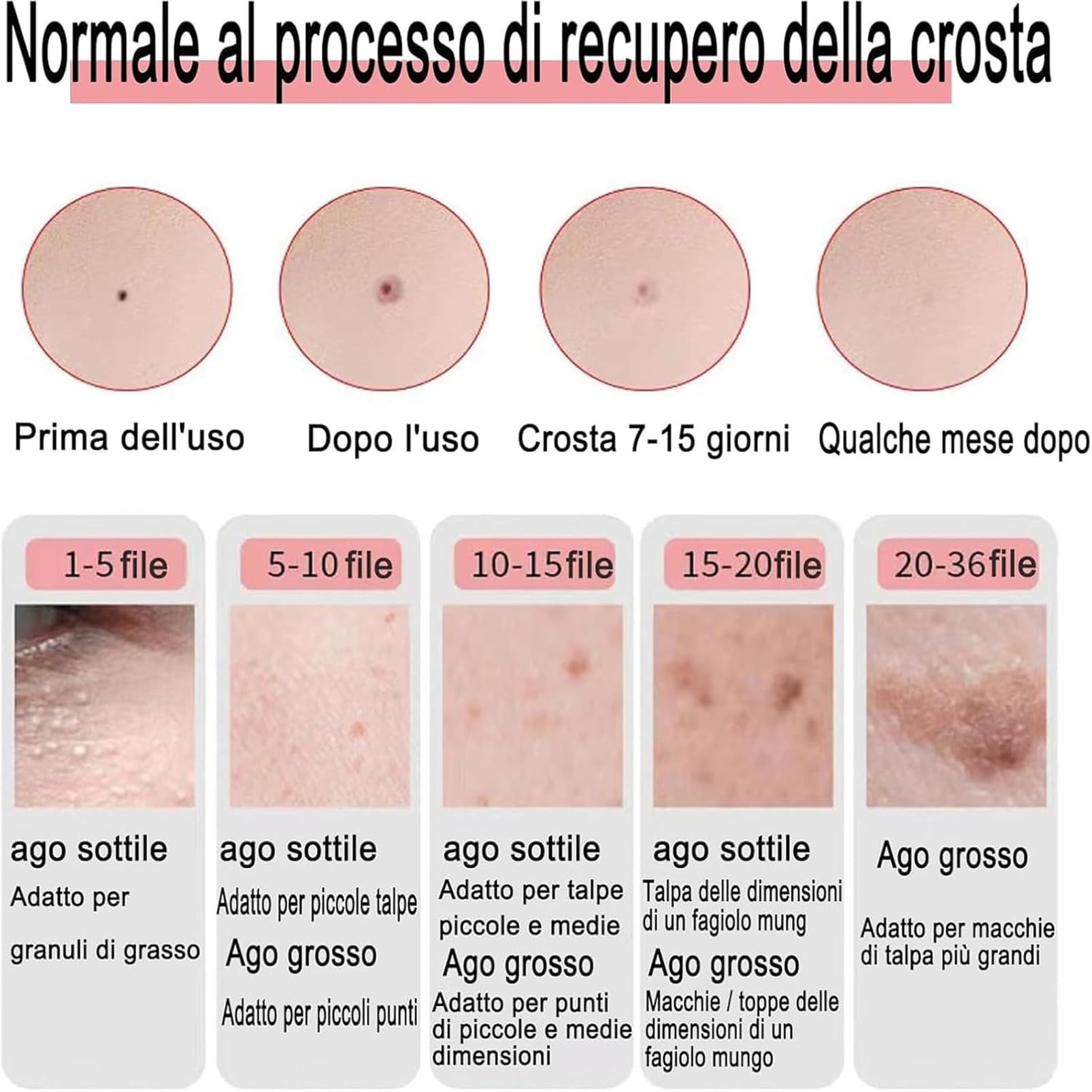 Stylo Électronique Pour Enlever Les Tatouages ​​et Les Grains De Beauté, Stylo Pour Enlever Les Acrochordons Avec 10 Niveaux De Puissance Réglables,Outil De Soin Du Visage,Pour Les Taches Brunes