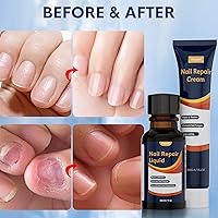 Vista 2 de Tratamiento de hongos en las uñas de los pies extra fuerte, tratamiento de hongos en las uñas para uñas gruesas, rotas y descoloridas, líquido