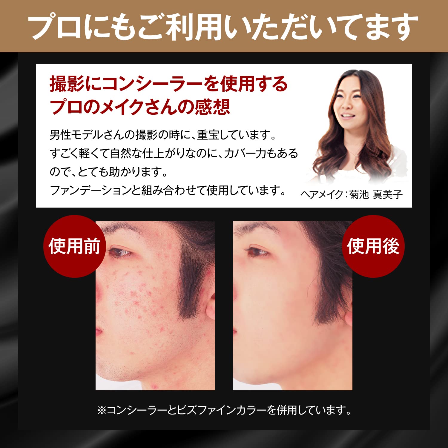 Amazon | ザス チップオンコンシーラー（ダーク）しみ あざ ほくろ