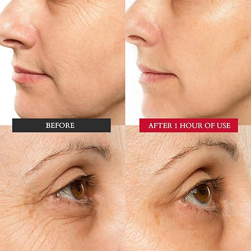 Miniatura 6 de Crema hidratante curativa Chuda para la piel, intensiva, para el envejecimiento de la piel, facial diario para piel seca y sensible, crema facial