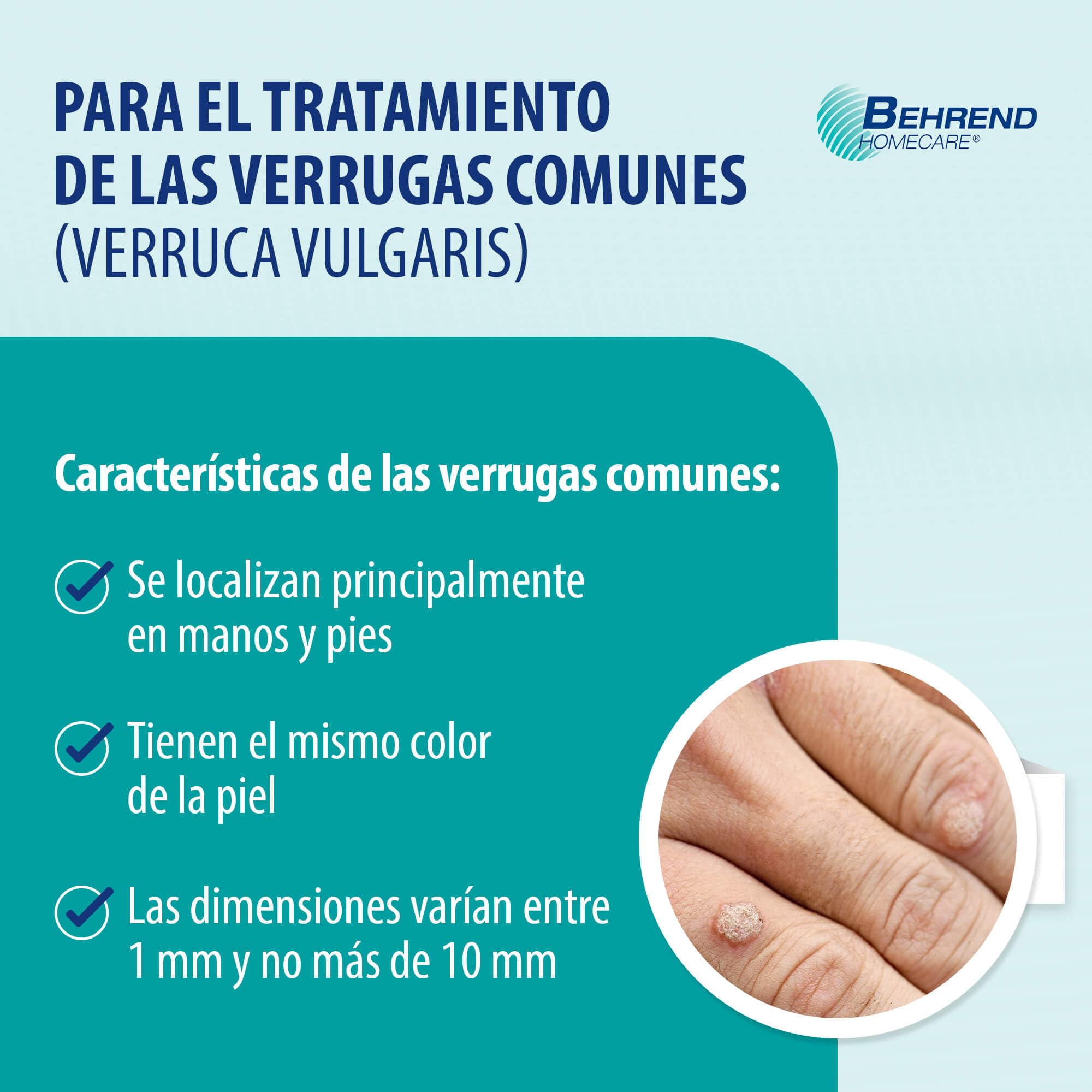 Behrend - Contra las verrugas en manos y pies - preciso, indoloro y seguro - apto para niños a partir de 4 años - Eficacia clínicamente probada (2 ml)