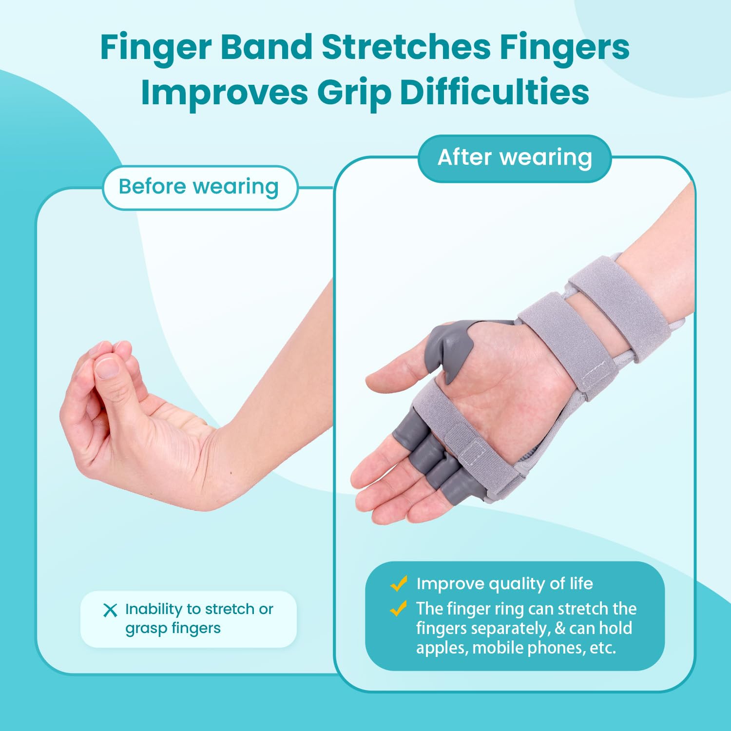 Radial Nerve Palsy Splint Brace for Wrist drop, 5 Fingers Extension, Stroke Patient Recovery, Finger Limp, Crutch Palsy, MCP Arthroplasty, for both Left and Right Hand - Gray