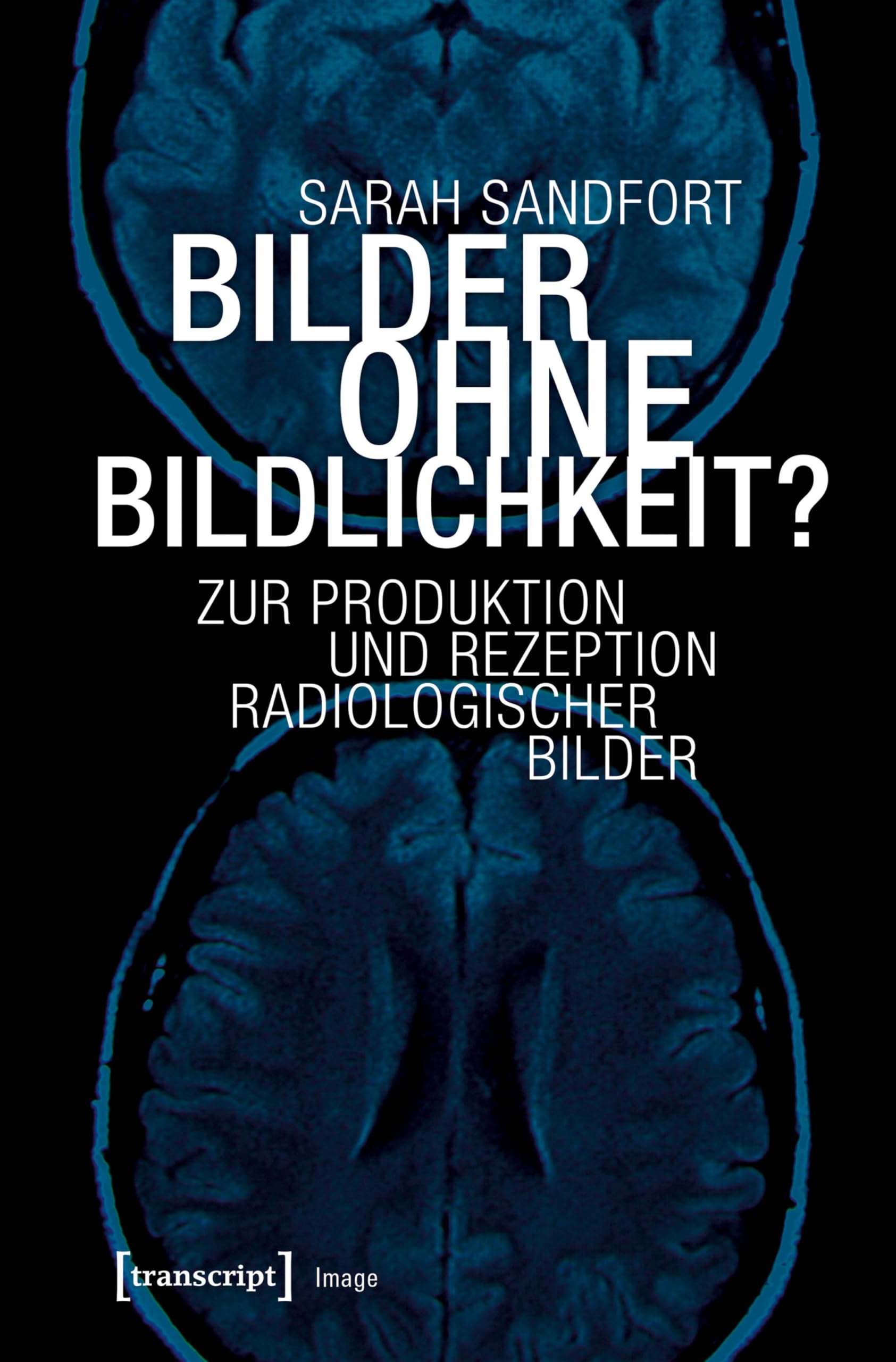 Radiologischer Bilder livre allemand Image 153 comprendre imagerie m&eacute;dicale